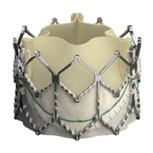 サピエンXT（エドワーズ社提供）の写真